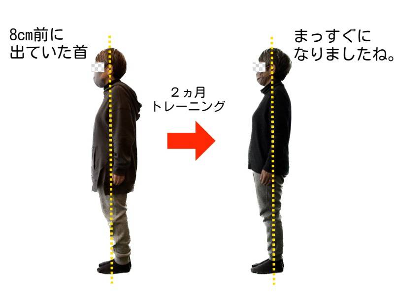 猫背内臓圧迫 _ 猫背による体への影響 – NFERC