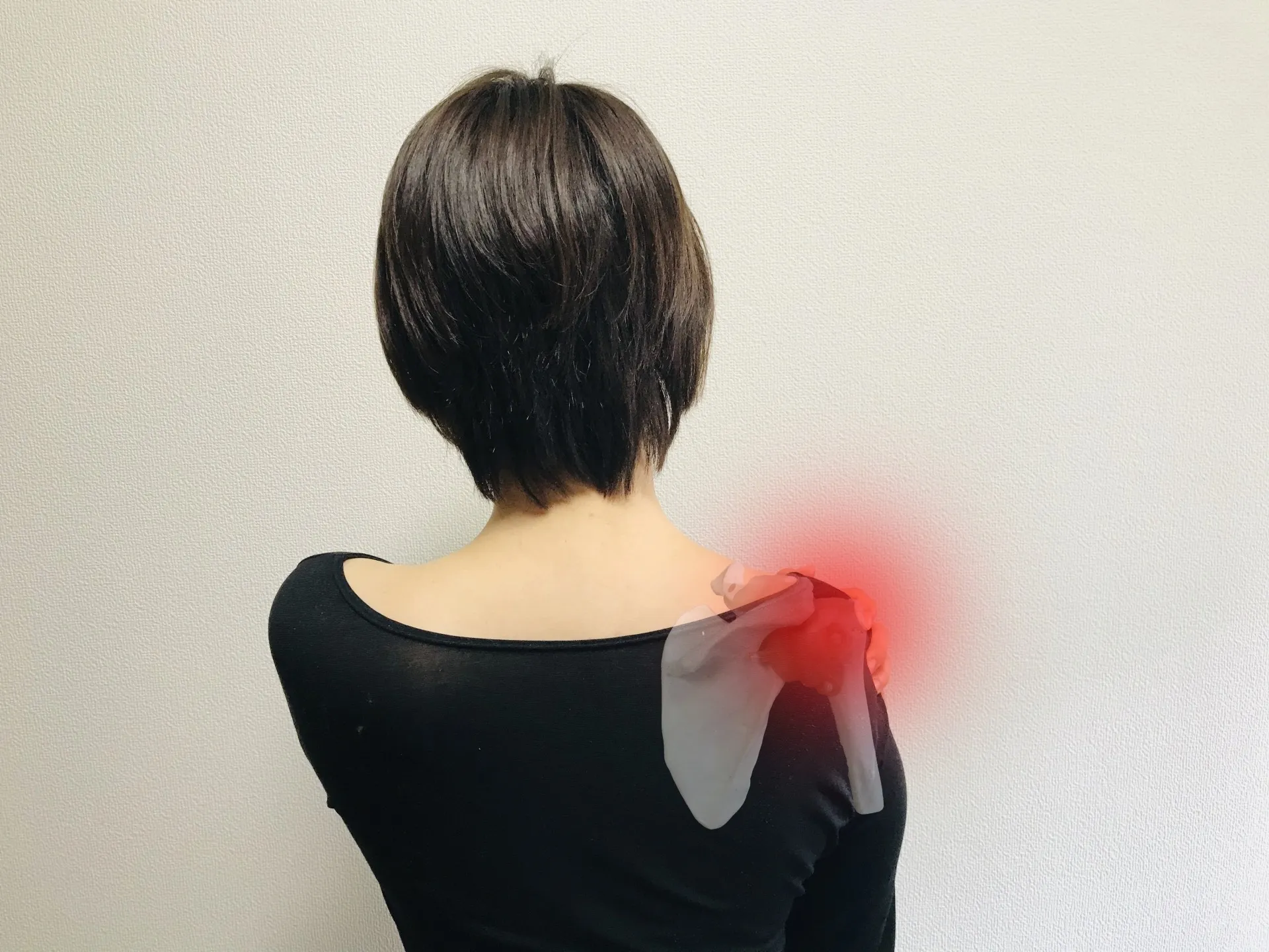 五十肩（肩関節周囲炎）、けん板断裂の痛みや運動｜理学療法士のいるリハビリジムで